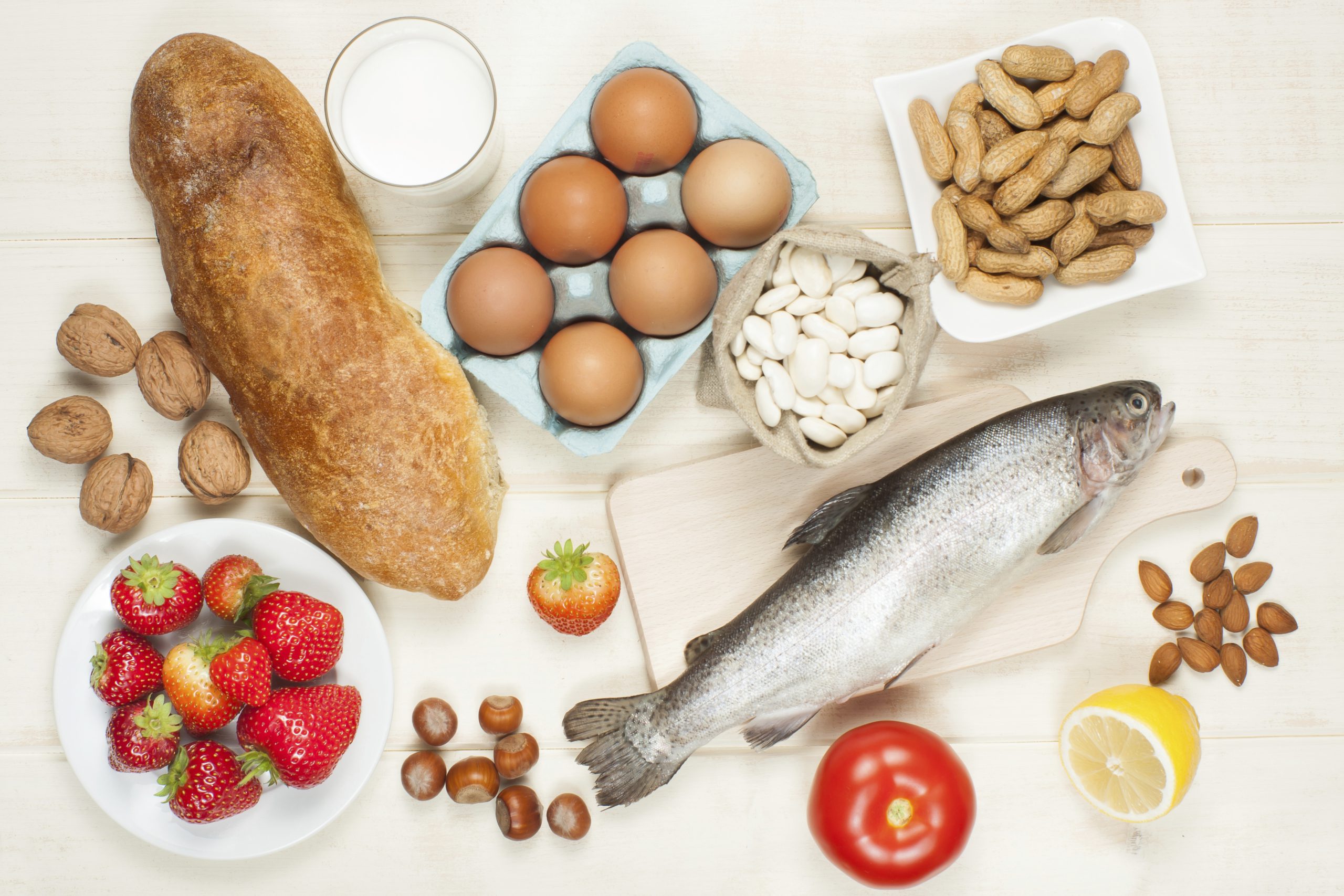 Food Allergies Food Allergies
