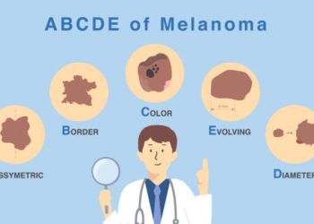 The ABCDEs of Skin Cancer