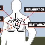 Wildfire Smoke and Lung Health Wildfire Smoke and Lung Health