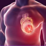Heart Attack Deaths Plummet: What’s Killing Us Now? Heart Attack Deaths Plummet