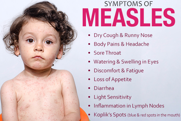Early Signs of Measles in Kids